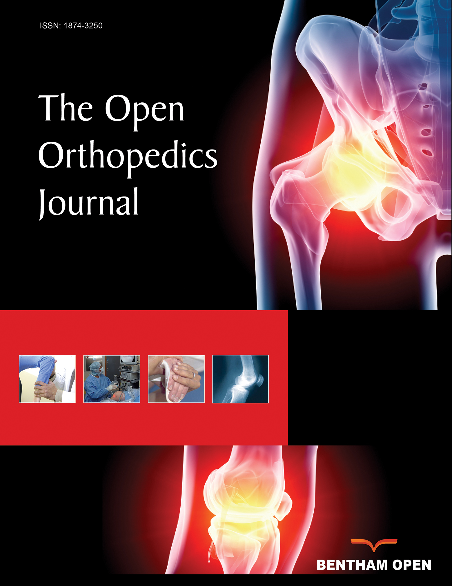 The Open Orthopaedics Journal